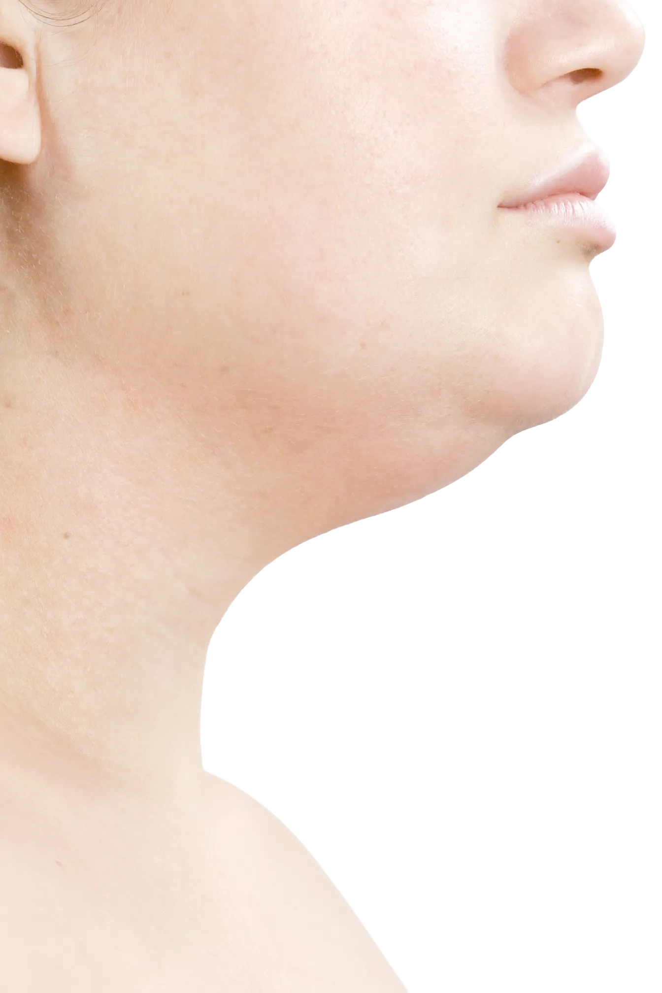 이중턱